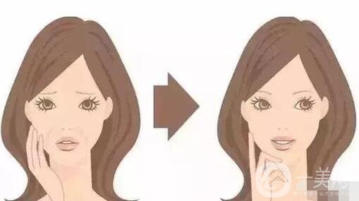 自體脂肪填充副作用及后遺癥是什么?