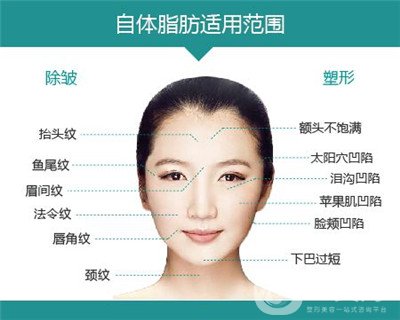 北京自體脂肪填充醫(yī)院有哪些？好的有哪些？