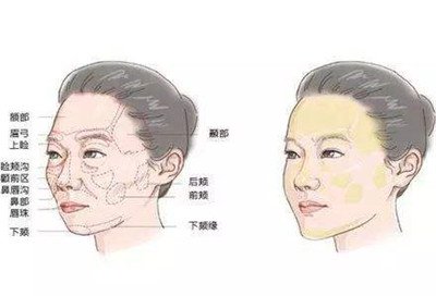 北京自體脂肪填充醫(yī)院有哪些？好的有哪些？