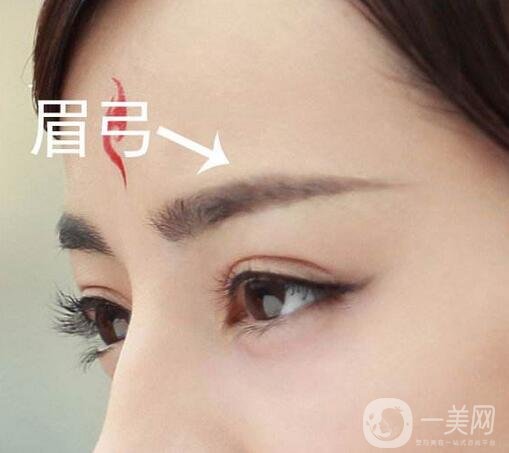 墊眉弓得打幾只玻尿酸?