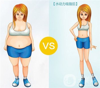 腰腹吸脂有積液怎么辦？不排出對身體有影響嗎？