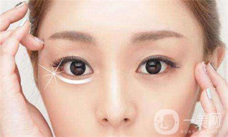 眼部提升手術(shù)怎么做？多久恢復(fù)？