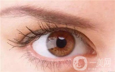  眼部整形費(fèi)用貴嗎？怎么收費(fèi)區(qū)別那么大？