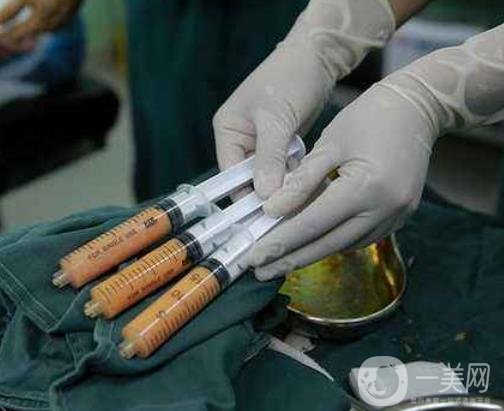 腰部吸脂的費(fèi)用大概多少錢？術(shù)后真的能瘦嗎？