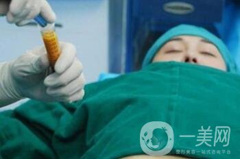 抽脂隆胸手術(shù)費用貴嗎？多少錢？