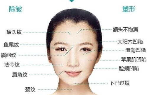 自體脂肪填充能保持幾年?會被完全吸收掉嗎?