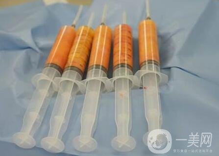 自體脂肪填充會留疤痕嗎?要注意些什么?