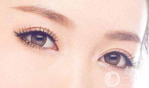 割雙眼皮過(guò)程大概需要多長(zhǎng)時(shí)間?