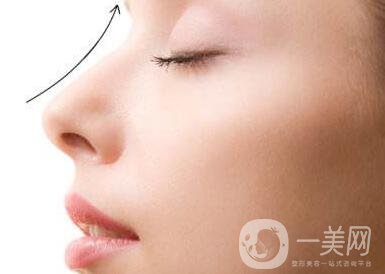 北京整容墊鼻梁多少錢？附隆鼻價格明細(xì)一覽表