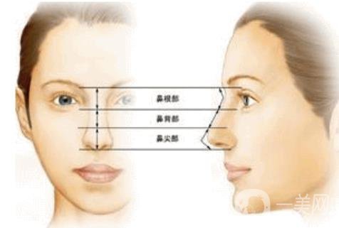 北京朝天鼻整容多少錢?具體怎么改良？