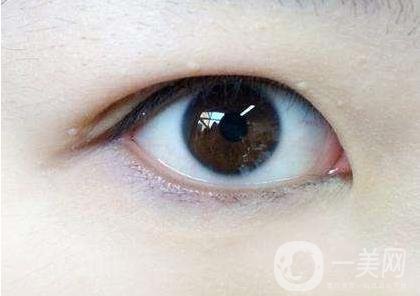 內(nèi)雙怎么變外雙？能貼雙眼皮貼嗎？