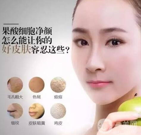 果酸換膚的危害有哪些?所有人都適合這種方式嗎?