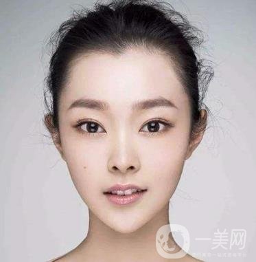 膨體隆下巴多久會(huì)變軟？容易取出來(lái)嗎？