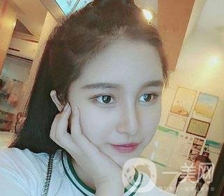 韓式肋軟骨隆鼻