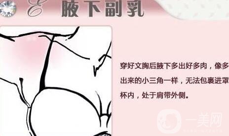 腋下副乳手術(shù)的價(jià)格是多少?影響因素有哪些呢?