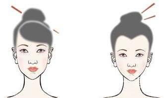 圓臉如何變瓜子臉?有哪些方法呢