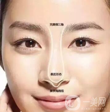 隆鼻手術怎么做？操作過程解析