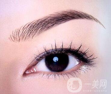 眉提升術(shù)適合哪些人?有什么方法