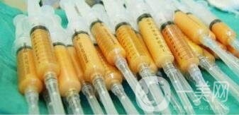 額部填充術(shù)