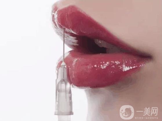 玻尿酸豐唇珠*果怎么樣?前期會腫嗎?