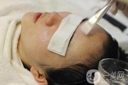 光子嫩膚價格多少？貴嗎？