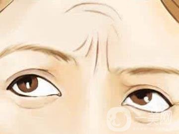 抬頭紋怎么去除？價格是多少呢？