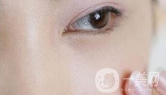 玻尿酸豐淚溝有危險(xiǎn)嗎？能管多久？