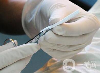 隆鼻術(shù)材料