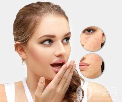 激光嫩膚價(jià)格一般是多少？*果好不好？