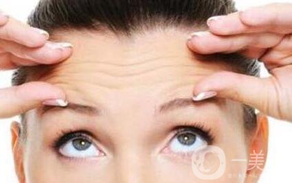 去抬頭紋*好的方法是什么?