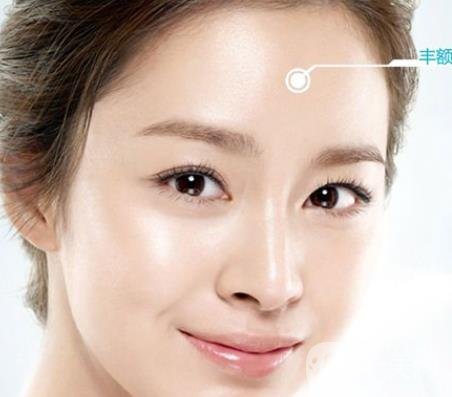 隆額頭材料哪種比較好？要多少錢？