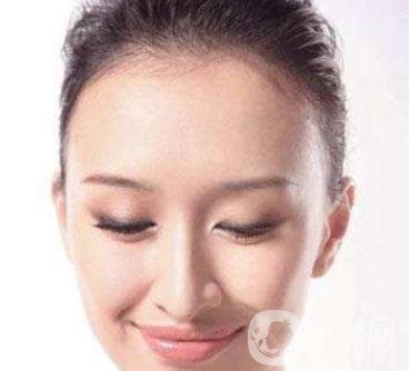 隆額頭材料哪種比較好？要多少錢？