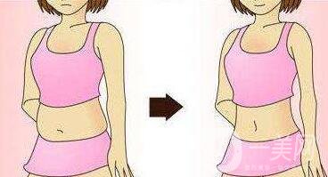 腹壁整形多少錢？費(fèi)用詳細(xì)解說