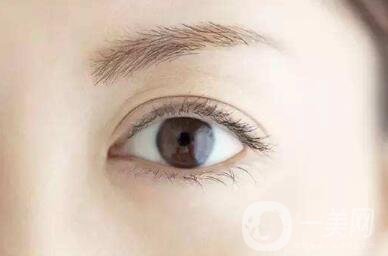 開眼角好嗎？*果怎么樣？