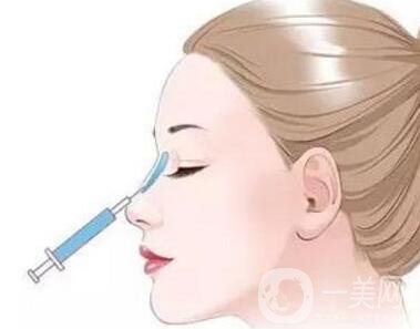 注射玻尿酸會(huì)腫嗎?