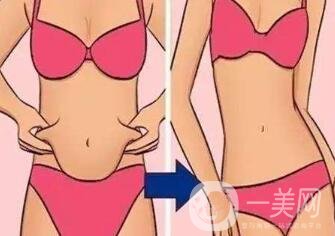 360度吸脂減肥是指環(huán)吸還是水動力？