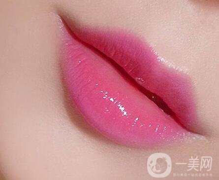 玻尿酸豐唇珠能夠保持多久？需要繼續(xù)注射嗎？