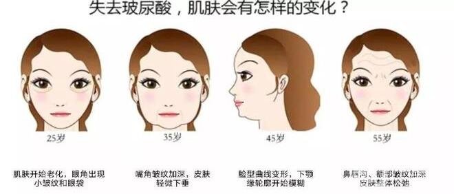 玻尿酸豐臉頰多少錢?與部位多少有關(guān)嗎?