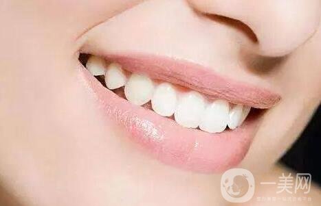 烤瓷牙價(jià)格和種類詳解公布