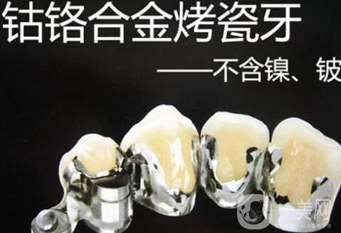 烤瓷牙價(jià)格和種類詳解公布