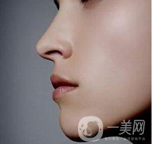 骨粉隆鼻后遺癥是什么樣的？