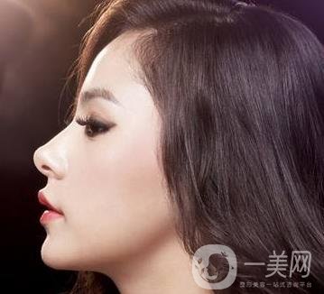 骨粉隆鼻后遺癥是什么樣的？