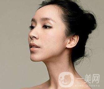 骨粉隆鼻后遺癥是什么樣的？