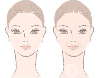 注射豐鼻唇溝*果*嗎？能立馬*果嗎？