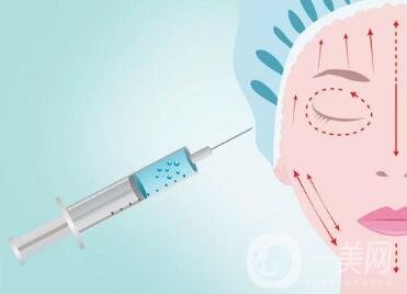 注射美容術(shù)可以改良臉部哪些情況？