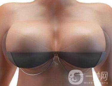 自身脂肪移植隆胸術(shù)有沒有副作用？