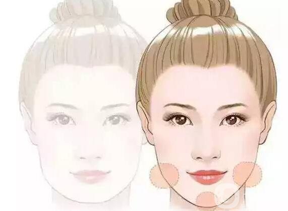 伊維蘭豐下巴大概多少錢啊?價(jià)格都一樣嗎