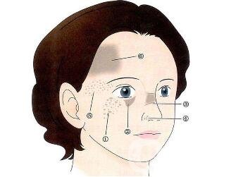 祛斑手術(shù)價格貴不貴？要多少錢？