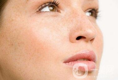 祛斑手術(shù)價格貴不貴？要多少錢？