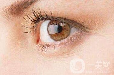 去除魚尾紋的方法有哪些？哪種方法比較好？